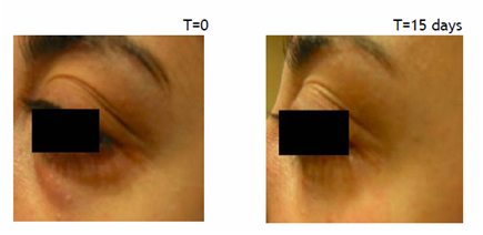 SkinPhD's Peptide Complex Eye Cream Results