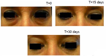 SkinPhD's Peptide Complex Eye Cream Results